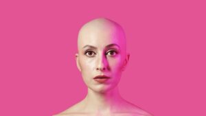 Q&A: Basic Bald B*tch